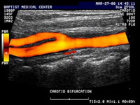 Diagnostic Medical Sonography Images