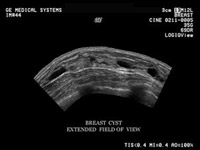 Diagnostic Medical Sonography Images